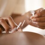 Patient Groups Demand Withdrawal of Acupuncture Bill Over Health Risks