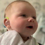 Successful Cochlear Implants for Two Babies in Nicosia