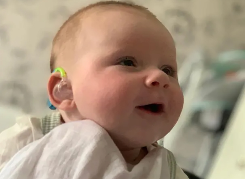 Successful Cochlear Implants for Two Babies in Nicosia